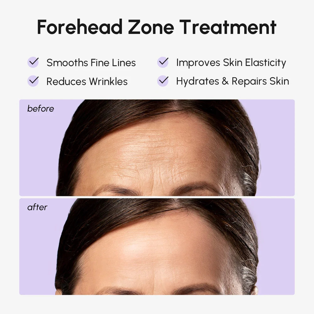 Anti-Wrinkle Forehead Patches – Wake Up With Smoother Skin